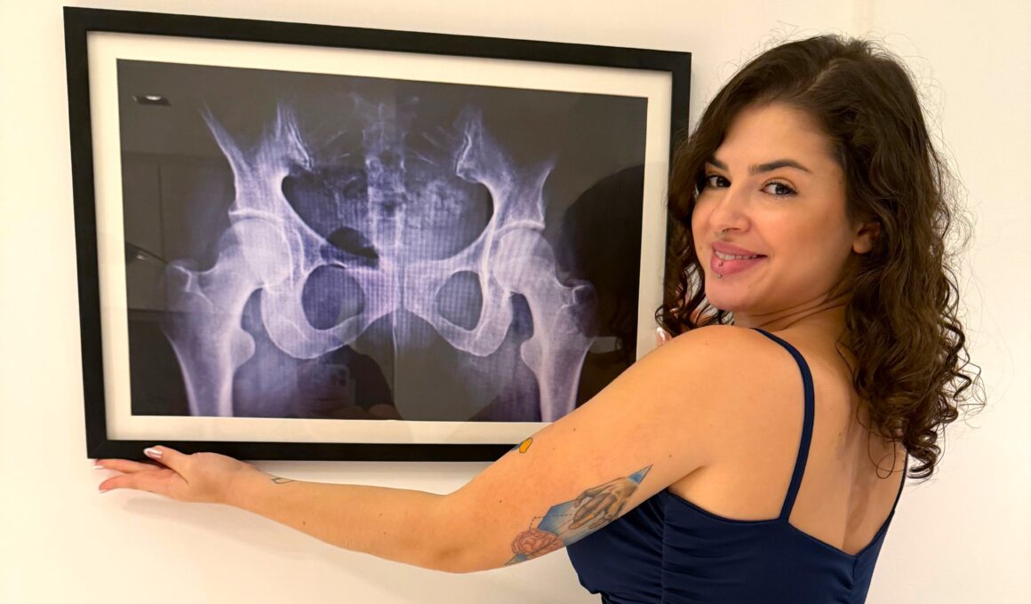 Brazilian influencer Kerolay Chaves, 24, framed an X-ray of her butt to prove her curves are natural, silencing surgery rumors ahead of the Miss BumBum 2025 pageant.