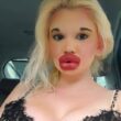 Influencer known for the world’s biggest lips says she was rejected by The Bachelor because of her extreme look and now hopes to find love with someone who accepts her fully.