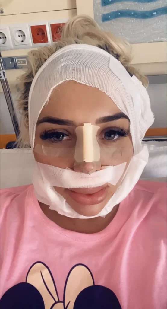 Amber May recovering from surgery on her nose. - NudeNewz